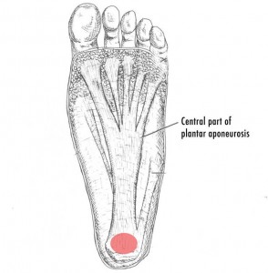 PF-PlantarDesignCrop-e